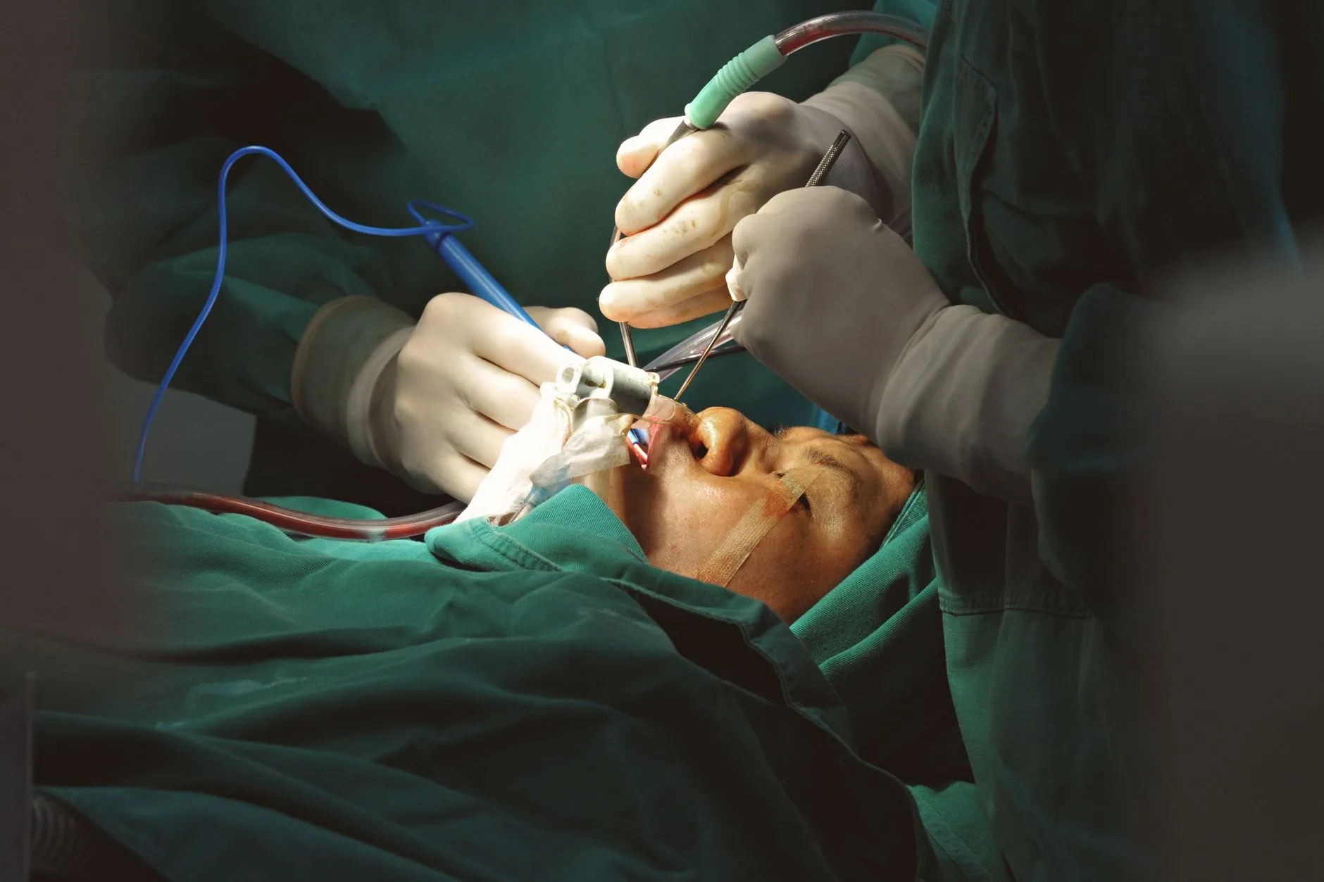 2025年薪酬体系设计新趋势：从宽带薪酬到敏捷激励的转型实践